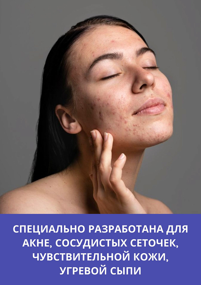 AzAc Forte 15% Cream - Крем для лица с 15% азелаиновой кислотой, 50 мл